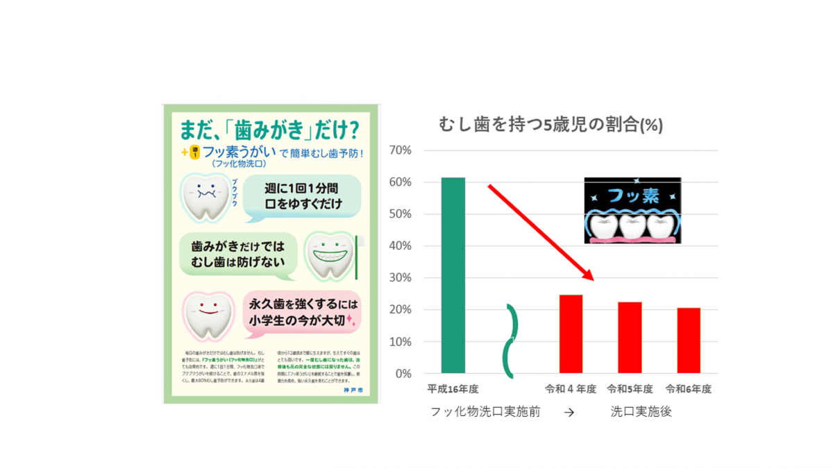 フッ化物